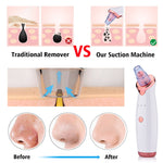 NEW BLACKHEAD/ACNE REMOVER & FACE DEEP CLEANER - ALKATEURE COLLECTIONS